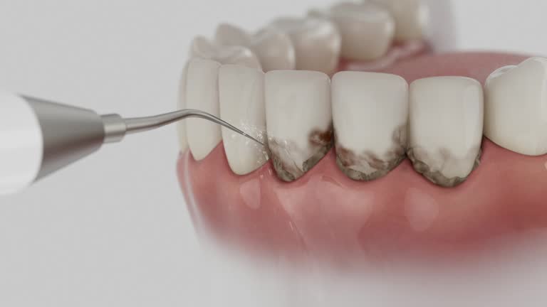 Reliable Dental contractor in Shell Ridge, CA by Dentist Open Now